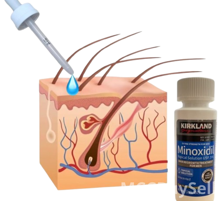 Hair Regrowth Treatment for Men