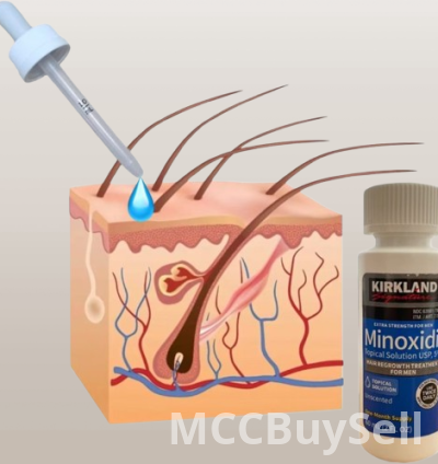 Hair Regrowth Treatment for Men 3