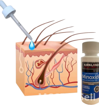 Hair Regrowth Treatment for Men 4